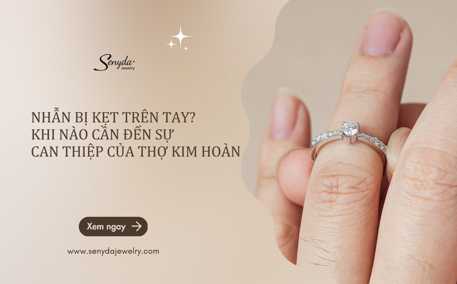 Nhẫn bị kẹt trên tay